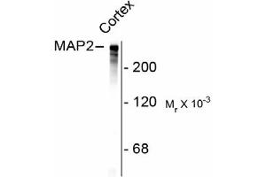 Image no. 1 for anti-Microtubule-Associated Protein 2 (MAP2) antibody (ABIN303924) (MAP2 anticorps)
