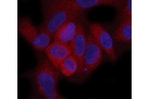 anti-Tuberous Sclerosis 1 (TSC1) (AA 1-618) antibody