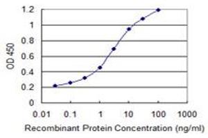 Detection limit for recombinant GST tagged CALML5 is 0. (CALML5 anticorps  (AA 1-146))
