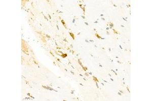 Immunohistochemistry of paraffin embedded mouse heart using SMYD2 (ABIN7075581) at dilution of 1:2000 (400x lens) (SMYD2A anticorps)