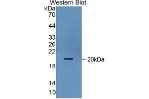 Western blot analysis of the recombinant protein. (IL17B anticorps  (AA 21-180))