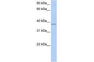 WB Suggested Anti-FGFR1OP Antibody Titration: 0. (FGFR1OP anticorps  (Middle Region))