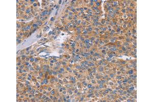 Immunohistochemistry (IHC) image for anti-Cell Division Cycle 7 (CDC7) antibody (ABIN2432827) (CDC7 anticorps)