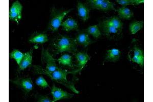 Anti-TUBAL3 mouse monoclonal antibody (ABIN2455275) immunofluorescent staining of COS7 cells transiently transfected by pCMV6-ENTRY TUBAL3 (RC216194). (TUBAL3 anticorps  (AA 150-446))