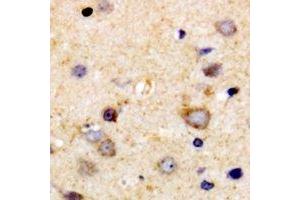 Immunohistochemical analysis of VEGFR3 staining in human brain formalin fixed paraffin embedded tissue section. (FLT4 anticorps)