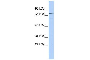 MELK antibody used at 1 ug/ml to detect target protein.
