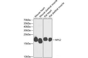 Western blot analysis of extracts of various cell lines using MYL2 Polyclonal Antibody at dilution of 1:500. (MYL2 anticorps)