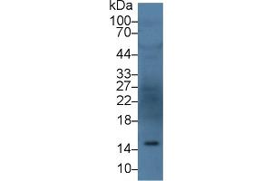 Detection of ANG in Human Serum using Polyclonal Antibody to Angiogenin (ANG) (ANG anticorps  (AA 25-147))