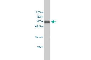 Western Blot detection against Immunogen (54. (PCNA anticorps  (AA 1-261))
