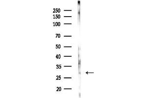 anti-Carcinoembryonic Antigen-Related Cell Adhesion Molecule 7 (CEACAM7) (Internal Region) antibody
