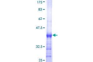 Image no. 1 for Membrane-Associated Ring Finger (C3HC4) 4, E3 Ubiquitin Protein Ligase (MARCH4) (AA 321-410) protein (GST tag) (ABIN1310367)