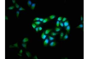 Immunofluorescence staining of Hela cells with ABIN7146901 at 1:40, counter-stained with DAPI. (FLIP anticorps  (AA 1-250))