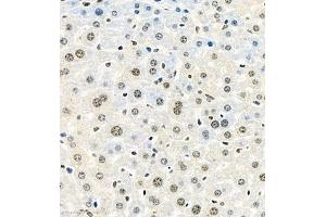 Immunohistochemistry of paraffin embedded mouse liver using HIF-3α (ABIN7074273) at dilution of 1:1600 (400x lens)