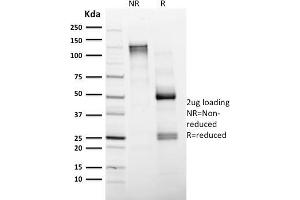 SDS-PAGE Analysis Purified CD4 Mouse Monoclonal Antibody (CD4/1604). (CD4 anticorps  (AA 245-392))