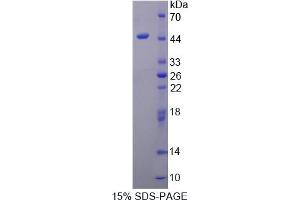 Image no. 1 for Protein Phosphatase, Mg2+/Mn2+ Dependent, 1A (PPM1A) (AA 2-382) protein (His tag) (ABIN4990690) (PPM1A Protein (AA 2-382) (His tag))