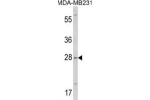 Western Blotting (WB) image for anti-Collectin Sub-Family Member 11 (COLEC11) antibody (ABIN3002827) (COLEC11 anticorps)