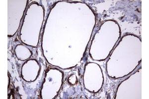 Image no. 14 for anti-Tumor Necrosis Factor Receptor Superfamily, Member 8 (TNFRSF8) (AA 19-379) antibody (ABIN1491084)