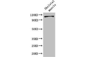 Western Blot Positive WB detected in: Mouse skeletal muscle tissue All lanes: EPHB6 antibody at 2 μg/mL Secondary Goat polyclonal to rabbit IgG at 1/50000 dilution Predicted band size: 111, 82, 58 kDa Observed band size: 111 kDa (EPH Receptor B6 anticorps  (AA 410-553))