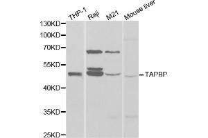 Western blot analysis of extracts of various cell lines, using TAPBP antibody. (TAPBP anticorps)