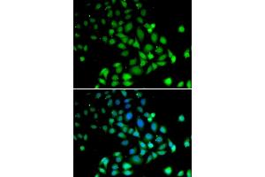Immunofluorescence analysis of U2OS cells using PARN antibody (ABIN1681249, ABIN3018397, ABIN3018398 and ABIN6220460). (PARN anticorps  (AA 1-280))