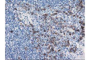 Image no. 1 for anti-Aryl Hydrocarbon Receptor Interacting Protein-Like 1 (AIPL1) antibody (ABIN1496508) (AIPL1 anticorps)