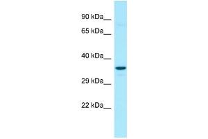 WB Suggested Anti-G6PC3 Antibody Titration: 1. (G6PC3 anticorps  (N-Term))