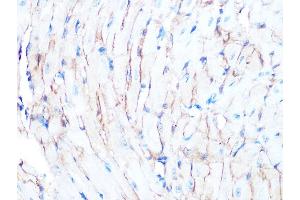Immunohistochemistry of paraffin-embedded mouse heart using Dystrophin Rabbit mAb (ABIN7266871) at dilution of 1:100 (40x lens). (Dystrophin anticorps)