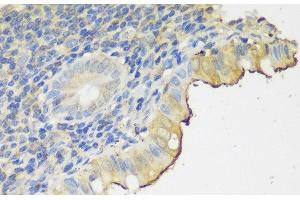 Immunohistochemistry of paraffin-embedded Human appendix using CLN5 Polyclonal Antibody at dilution of 1:150 (40x lens). (CLN5 anticorps)