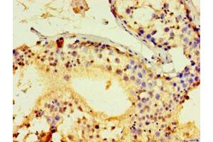 Immunohistochemistry of paraffin-embedded human testis tissue using ABIN7143026 at dilution of 1:100 (ACRV1 anticorps  (AA 22-265))