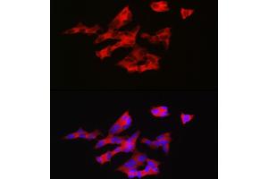 Immunofluorescence analysis of SH-SY5Y cells using GNRH1 Rabbit pAb (ABIN6131875, ABIN6141257, ABIN6141258 and ABIN6221260) at dilution of 1:200 (40x lens). (GNRH1 anticorps  (AA 24-92))