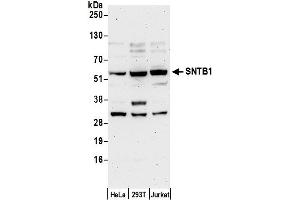 Western Blotting (WB) image for anti-Syntrophin, beta 1 (Dystrophin-Associated Protein A1, 59kDa, Basic Component 1) (SNTB1) (AA 75-125) antibody (ABIN7450752)