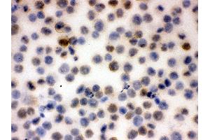 Anti-CD43 Picoband antibody, ICC ICC: K562 Cell