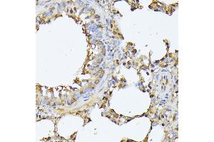 Immunohistochemistry of paraffin-embedded rat lung using PSMB3 antibody (ABIN6131929, ABIN6146317, ABIN6146318 and ABIN6225280) at dilution of 1:100 (40x lens).
