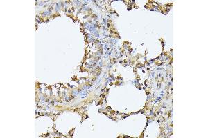 Immunohistochemistry of paraffin-embedded rat lung using PSMB3 antibody (ABIN6131929, ABIN6146317, ABIN6146318 and ABIN6225280) at dilution of 1:100 (40x lens). (PSMB3 anticorps  (AA 1-205))