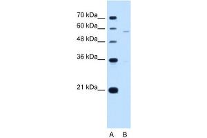 PIGV antibody used at 1 ug/ml to detect target protein. (PIGV anticorps  (N-Term))