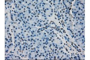 Immunohistochemical staining of paraffin-embedded pancreas tissue using anti-CRYABmouse monoclonal antibody. (CRYAB anticorps)