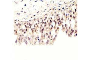 Immunohistochemical analysis of paraffin-embedded H. (Pan SUMO anticorps)