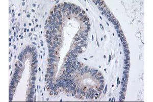 Immunohistochemistry (IHC) image for anti-X-Prolyl Aminopeptidase (Aminopeptidase P) 3, Putative (XPNPEP3) antibody (ABIN1501765)