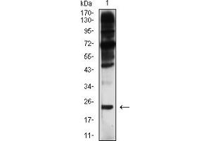 Western blot analysis using BAX mouse mAb against HT1080 (1) cell lysate. (BAX anticorps)