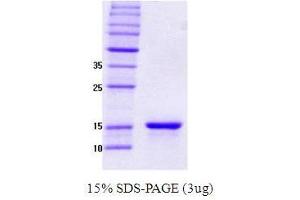 Figure annotation denotes ug of protein loaded and % gel used. (SNCG Protéine)