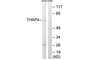 Western blot analysis of extracts from COS7 cells, using THAP4 Antibody. (THAP4 anticorps  (AA 341-390))