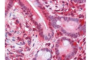 Immunohistochemical analysis of paraffin-embedded human Small Intestine tissues using PAR4 antibody (F2RL3 anticorps  (AA 1-330))