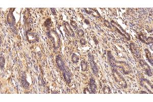 Detection of TGM2 in Human Uterus Tissue using Polyclonal Antibody to Transglutaminase 2 (TGM2)