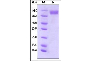 Biotinylated Human CD200 R1, Fc,Avitag on  under reducing (R) condition.
