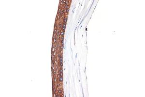 Immunohistochemistry of paraffin-embedded Mouse cornea using Cytokeratin 12 (KRT12) (KRT12) Rabbit mAb (ABIN7268087) at dilution of 1:100 (40x lens).