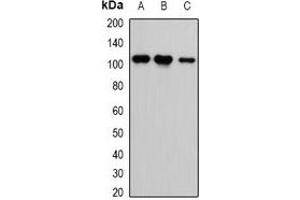 Western blot analysis of CASK expression in HEK293T (A), H460 (B), A549 (C) whole cell lysates. (CASK anticorps)