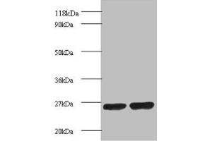 Western blot All lanes: Proteasome subunit beta 1 antibody at 2 μg/mL Lane 1: EC109 whole cell lysate Lane 2: 293T whole cell lysate Secondary Goat polyclonal to rabbit IgG at 1/15000 dilution Predicted band size: 27 kDa Observed band size: 27 kDa (PSMB1 anticorps  (AA 29-241))