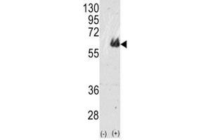 Western blot analysis of TAU antibody and 293 cell lysate (2 ug/lane) either nontransfected (Lane 1) or transiently transfected with the TAU gene (2). (tau anticorps  (AA 677-707))