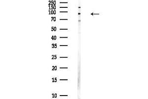 Western blot analysis of lysates from Hela cells(heat-shock,45 min treatment), using ZNF341 Antibody at 1/1000 dilution.