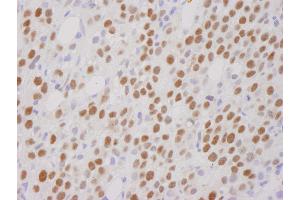 Immunohistochemistry (IHC) image for anti-REST Corepressor 1 (RCOR1) (C-Term) antibody (ABIN7448481) (CoREST anticorps  (C-Term))
